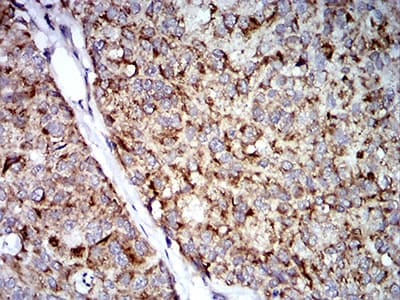 Monoclonal Mouse anti-Human TRIM25 Antibody (clone 5B5B12, IHC, IF, WB)