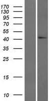 GADL1 Protein (Over-Expression Lysate Myc-DDK (Flag))