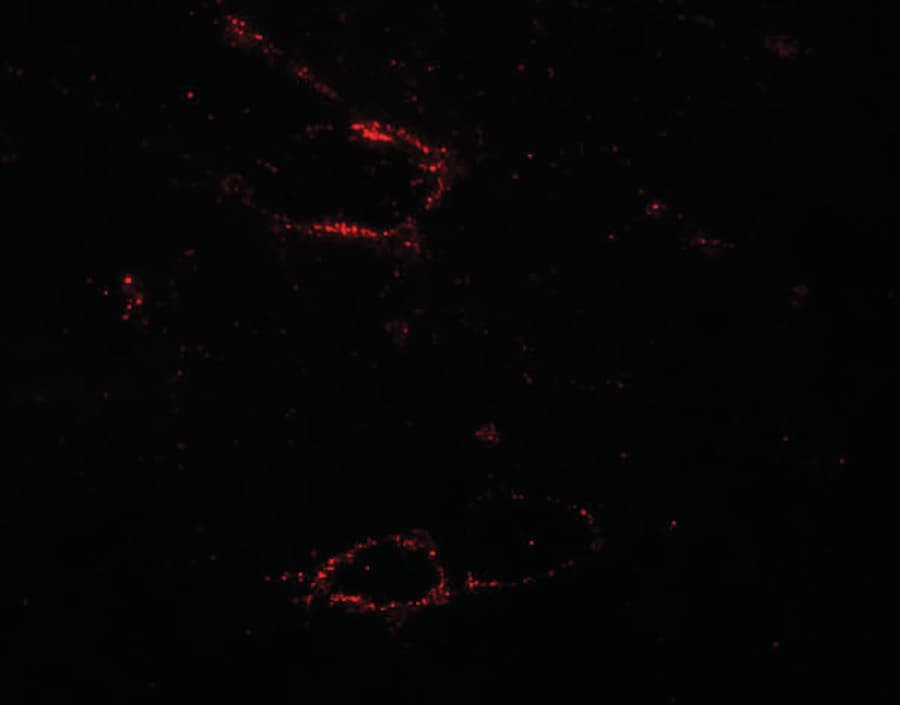 SYNPO2L Antibody