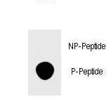 FOXP3 Antibody (phospho-Ser418)