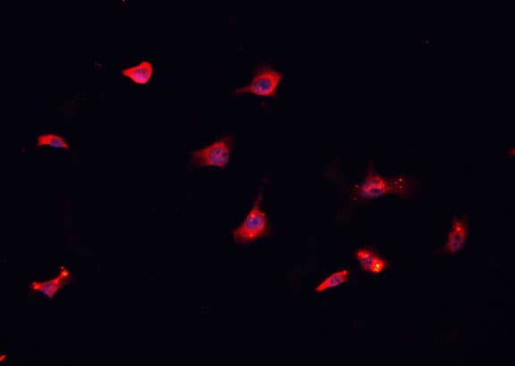 Polyclonal Rabbit anti-Human CD151 Antibody (IHC, IF, WB)