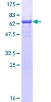 Human TWF2 / PTK9L Protein (Recombinant GST)