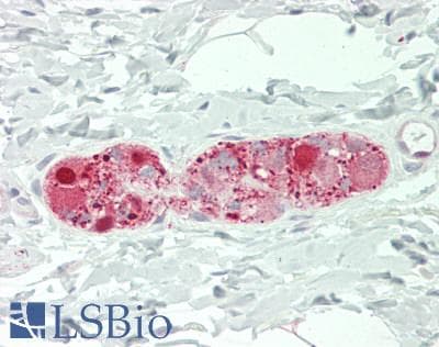 IHC-plus™ SNCG / Gamma-Synuclein Antibody