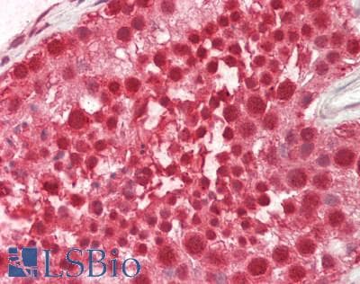 Polyclonal Rabbit anti-Mouse CSTF2 / CstF-64 Antibody (N-Terminus, IHC, WB)