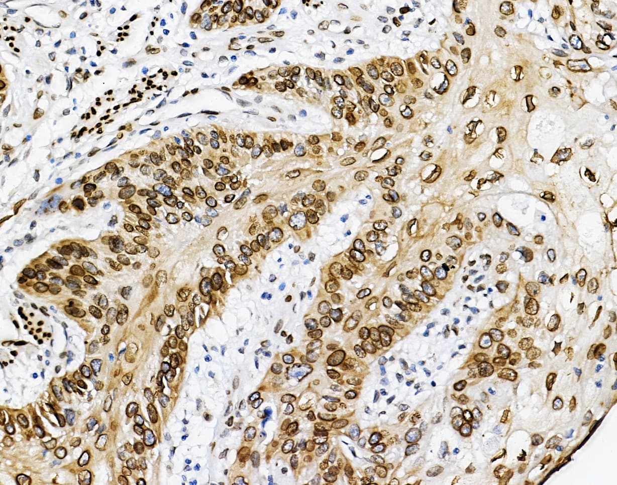 Polyclonal Rabbit anti-Human EMD / Emerin Antibody (IHC, WB)