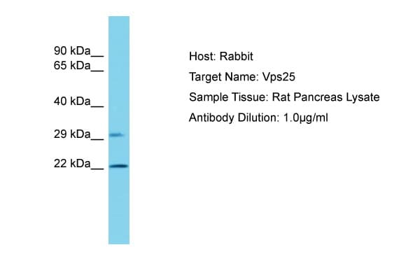 VPS25 Antibody (C-Terminus)