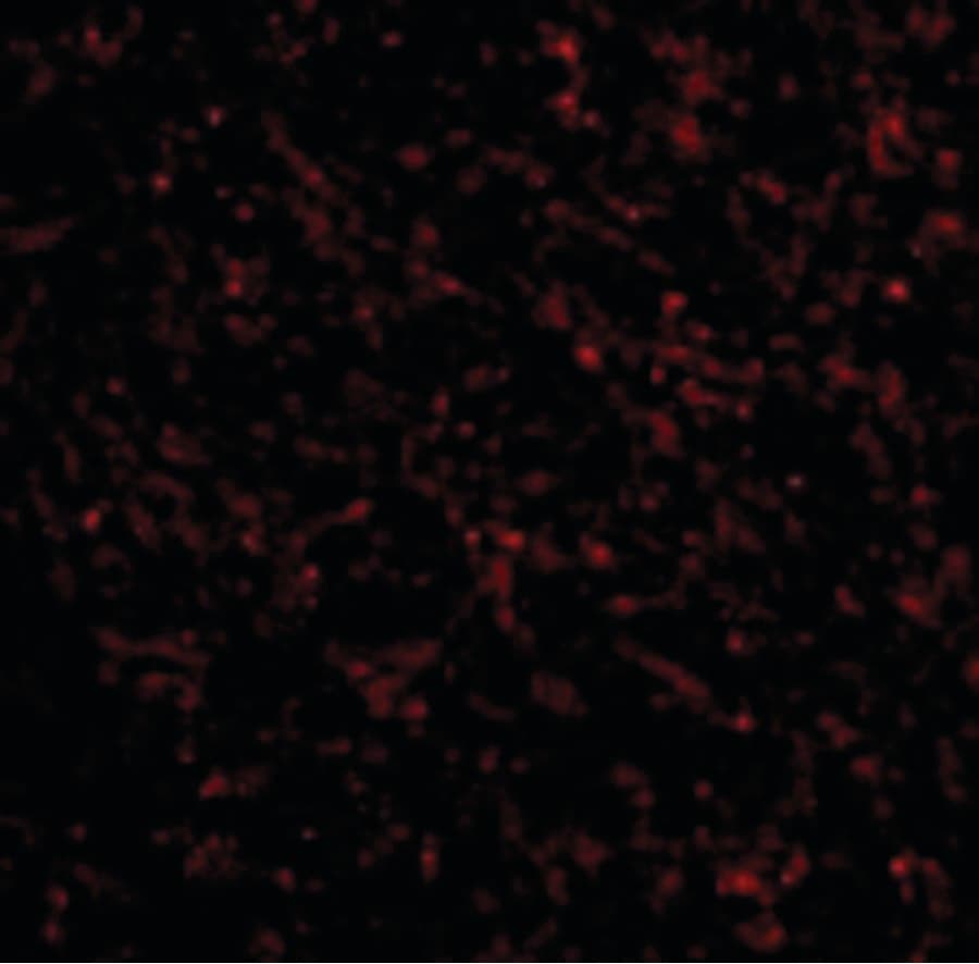 TACR3 / NK3R Antibody