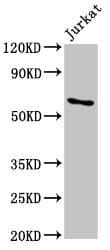 CRD-BP / ZBP1 / IGF2BP1 Antibody