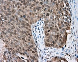 BTK Antibody (clone OTI15G8)