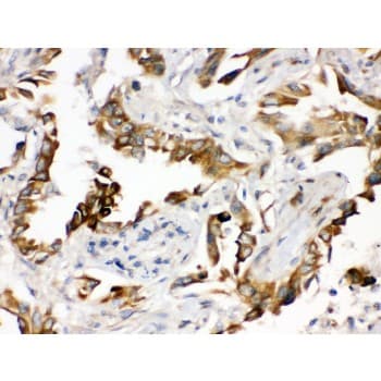 Polyclonal Rabbit anti-Human PGRMC1 / MPR Antibody (aa67-102, IHC, WB)