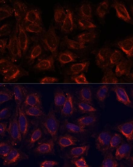 SCGB3A2 Antibody