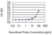 HPN / TMPRSS1 / Hepsin Antibody (clone 2D5)