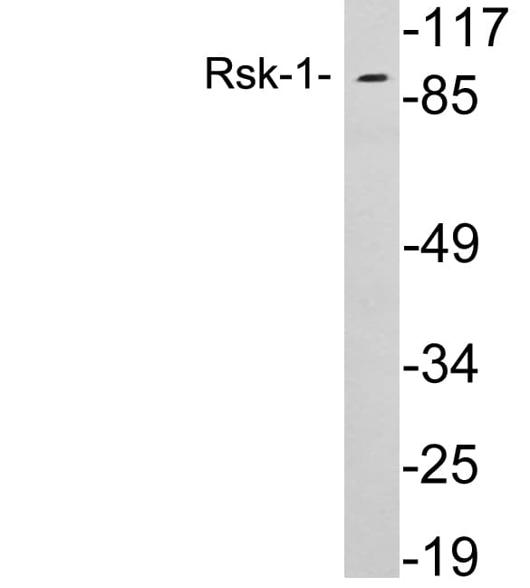 RPS6KA1 / RSK1 Antibody (aa524-573)