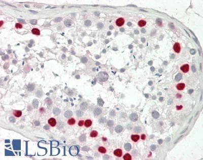 IHC-plus™ Polyclonal Rabbit anti-Human POLK / DNA Polymerase Kappa Antibody (IHC, IF, WB)