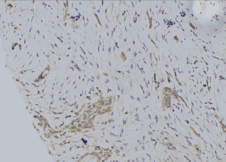 CYP2S1 Antibody