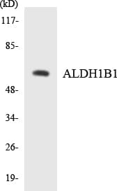 ALDH1B1 Antibody (aa299-348)