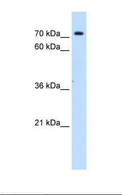 SLC5A11 / SMIT2 Antibody (aa226-275)
