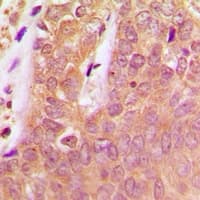 PTPN6 / SHP1 Antibody (C-Terminus)
