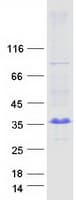 Human ARL10 Protein (Recombinant Myc-DDK (Flag))