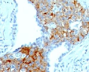 Monoclonal Mouse anti-Human TRIM29 Antibody (clone TRIM29/1041, aa1-200, IHC, IF)