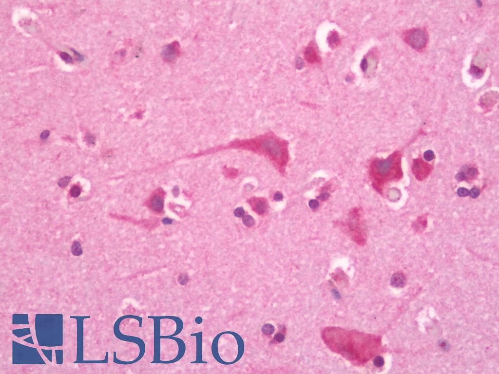 IHC-plus™ Polyclonal Rabbit anti-Human EDA / Ectodysplasin A Antibody (IHC, IF, WB)