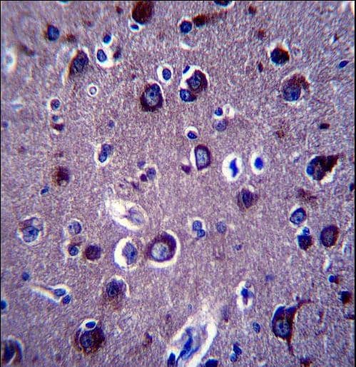 APP / Beta Amyloid Precursor Antibody (aa333-362)