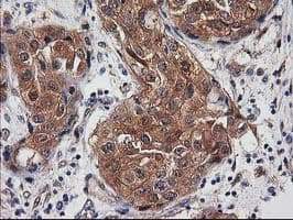 DSTN / Destrin Antibody (clone OTI1D8)