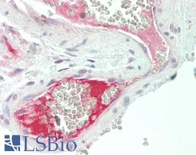 F13B / TGase Antibody (aa216-265, FITC)