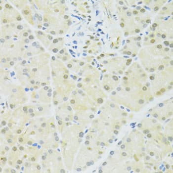 BRCA1 Antibody