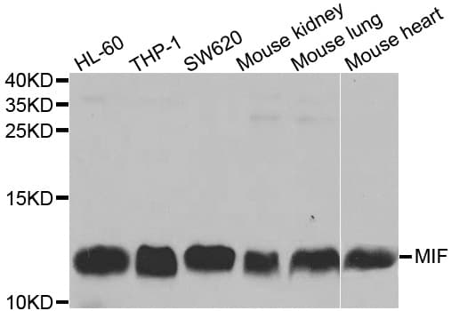Polyclonal Rabbit anti-Human MIF Antibody (IHC, IF, WB)