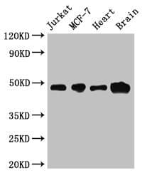 ZNF645 Antibody
