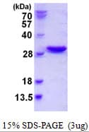 Human NXT2 Protein (Recombinant His)