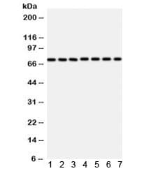 Polyclonal Rabbit anti-Human SDHA Antibody (WB)