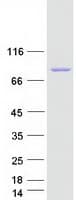 Human ACSL6 Protein (Recombinant Myc-DDK (Flag))