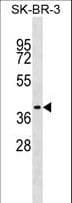 Polyclonal Rabbit anti-Human TRAM1 Antibody (aa346-372, WB)