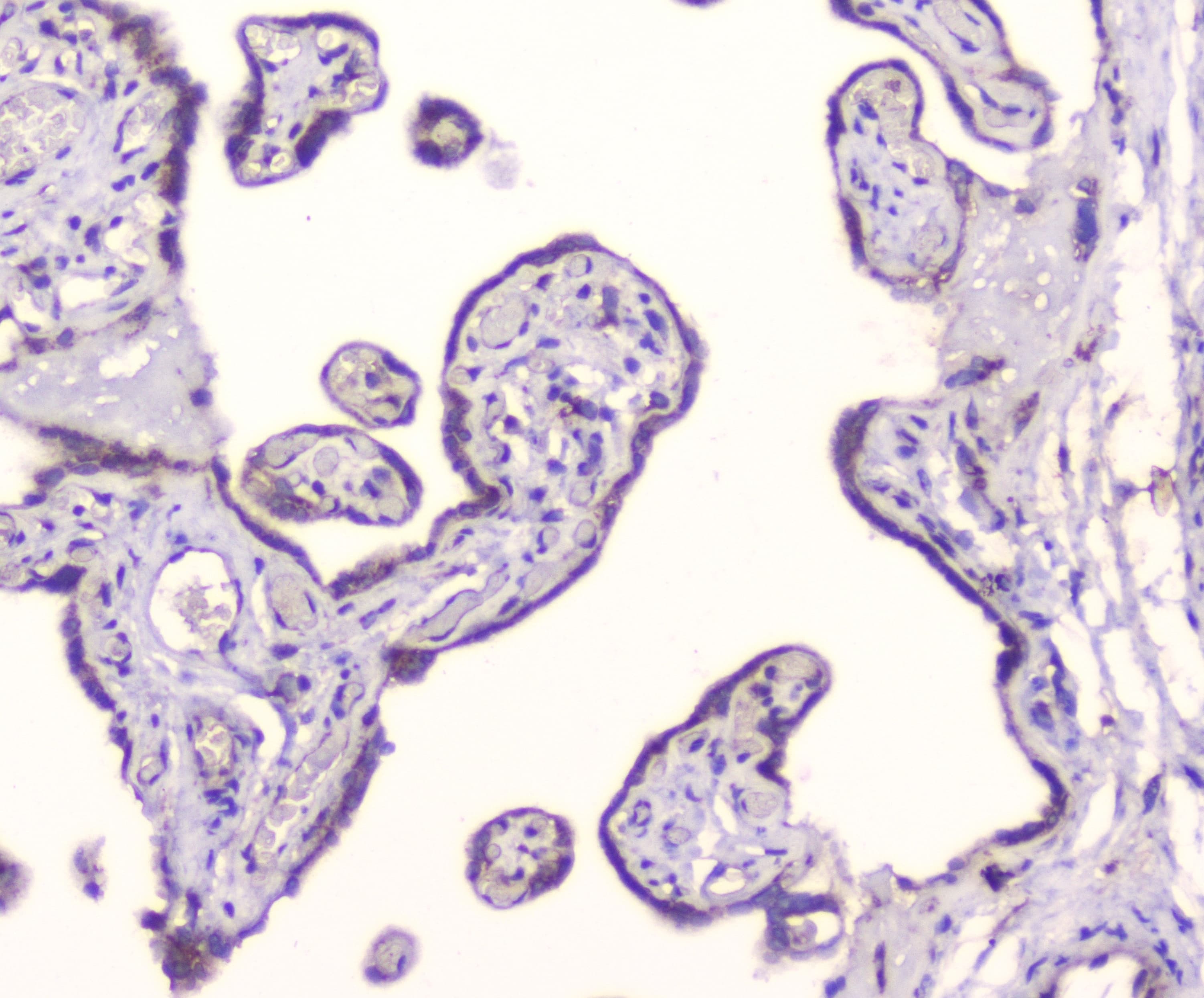 Polyclonal Rabbit anti-Human GOLGA2 / GM130 Antibody (IHC, WB)