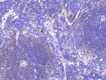 PCDH15 Antibody