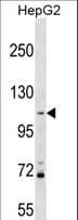 PROSER1 / C13orf23 Antibody (aa128-156)