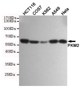 PKM / Pyruvate Kinase, Muscle Antibody