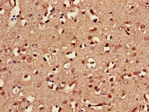 KLRD1 / CD94 Antibody