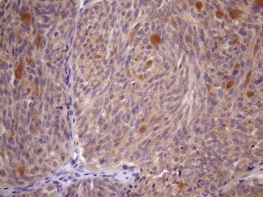 SSX2IP Antibody (aa1-272, clone OTI5C3, Carrier-free)