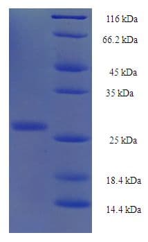 Human YPEL1 Protein (Recombinant His-SUMO)