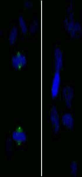 AURKA / Aurora-A Antibody (phospho-Thr288)
