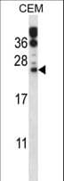 RAB6B Antibody (aa167-195)