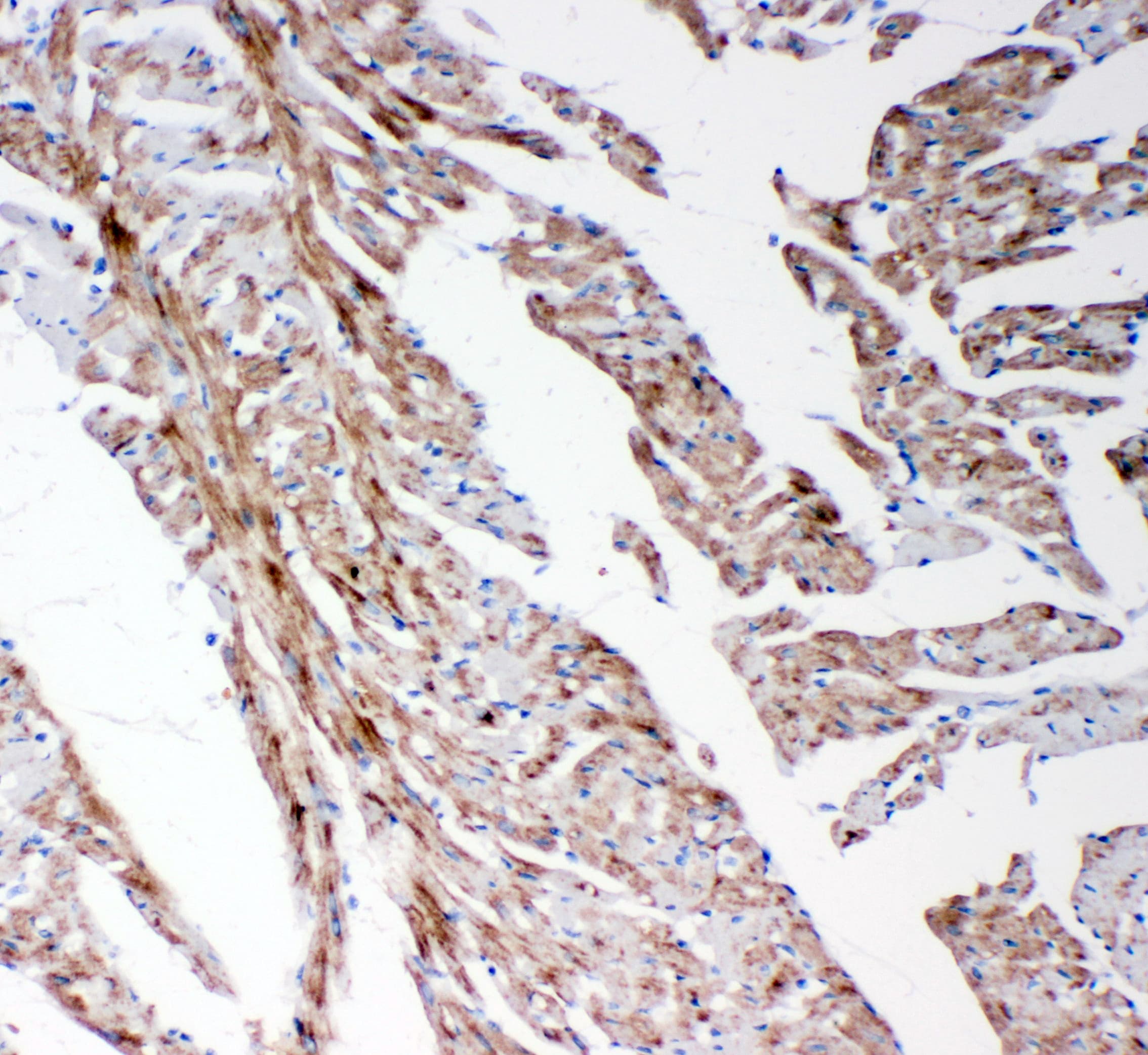 MMP14 Antibody (aa567-582)
