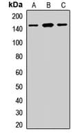DSG2 / Desmoglein 2 Antibody