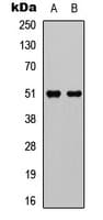 GPR152 Antibody (Internal)