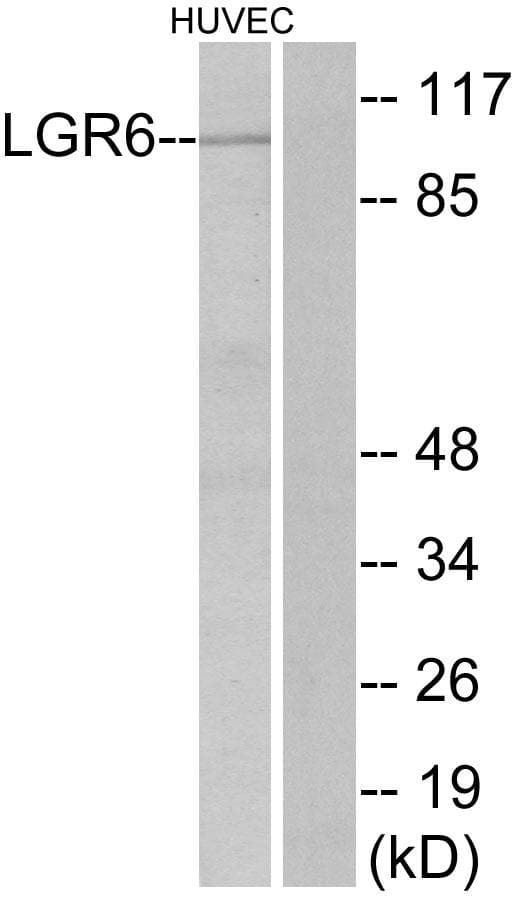 Polyclonal Rabbit anti-Human LGR6 Antibody (IF, WB)