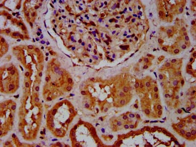Polyclonal Rabbit anti-Human CPNE8 / Copine VIII Antibody (IHC)