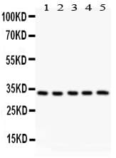 HSD11B1 / HSD11B Antibody (aa16-33)